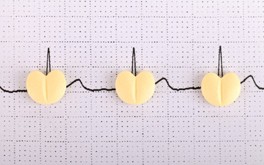 Electrocardiogram