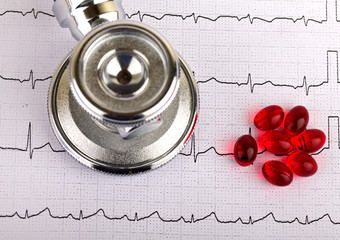 Electrocardiogram