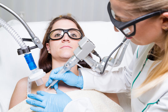 Leberfleck, entfernen, Laser