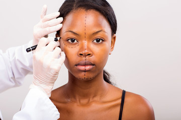 cosmetic surgeon drawing lines on african girl face