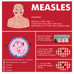 vector measles infographic. symptoms, statistics, virus scheme.