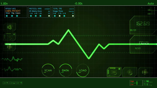 EKG screen