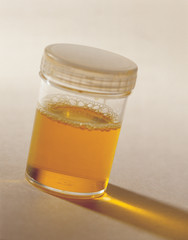 포토시리즈