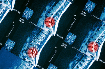 CT scan of human spine pattern