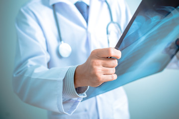 close up of male doctor holding x-ray or roentgen image