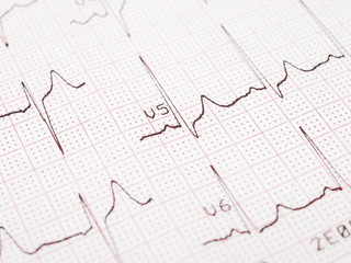 Electrocardiogram, ECG printout, EKG background