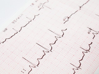 Electrocardiogram, ECG printout, EKG background