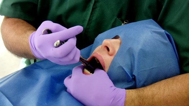 Dentist Pulling Molar Close Up