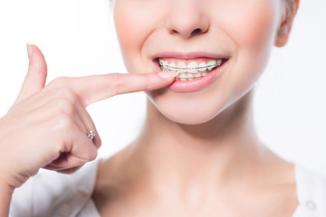 Woman with teeth braces