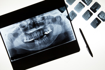 Panoramic dental X-Ray film for dentist