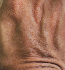 Fototapeta premium human skin texture