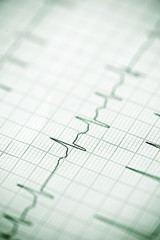 Electrocardiogram