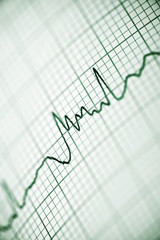 Electrocardiogram