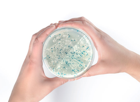 Hands Holding Agar Plate With Bacterial Colonies