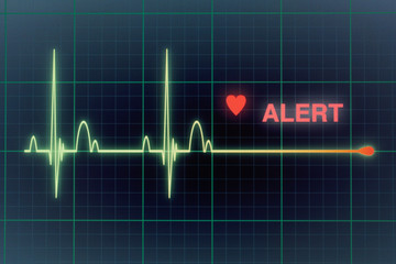 Heart beats cardiogram on the monitor. - 79601861