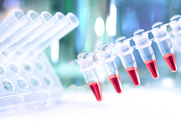 Plastic tubes prepared for amplification of DNA