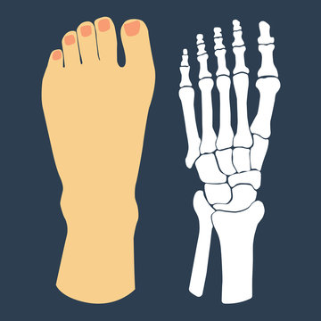 The flat design of the foot and the foot skeleton. Vector
