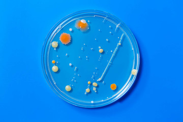 Petri dishes with colonies of pathogenic organisms