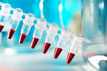 DNA samples in disposable plastic tubes for PCR analysis