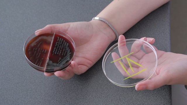 Hand with Petri dish shows visible bacterial culture