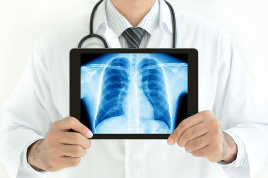 Doctor Holding Tablet Pc With Normal Male Chest X-ray Image