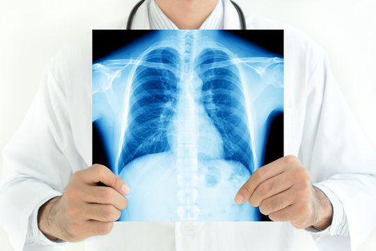 Doctor holding x-ray image of normal male chest