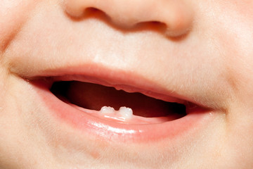 child first two teeth close up