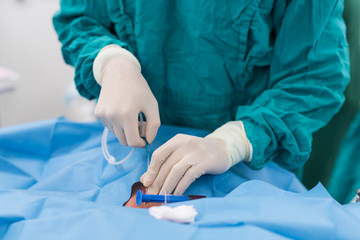 doctor apply guide wire to internal carotid vein