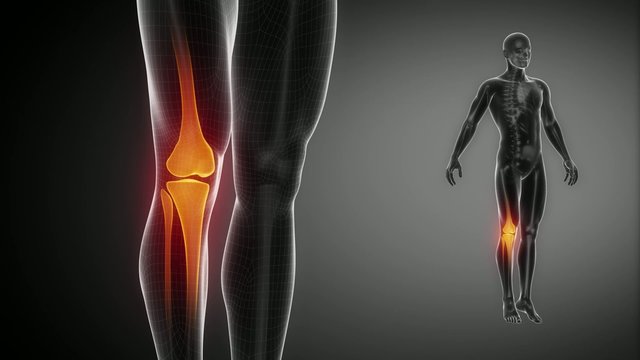 KNEE  bone skeleton x-ray scan in black