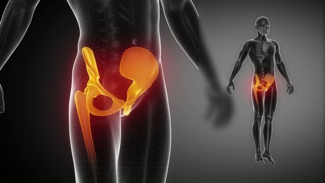 HIP joint bone skeleton x-ray scan in black