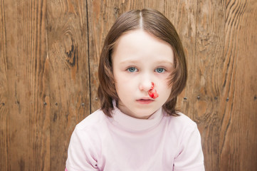 the girl bleeding from the nose