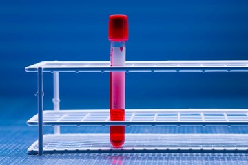 blood test