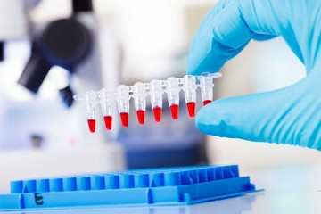 PCR strip test tubes and micropipette in genetics laboratory