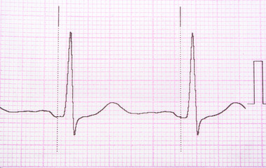 Cardiogram