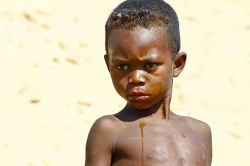 Young surprised african boy, poverty in Madagascar