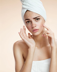 girl pointing her acne with a towel on her head