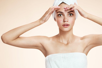 Girl squeezing her pimples, removing pimple from her face