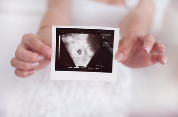 Pregnant women with the ultrasound picture - 80599206