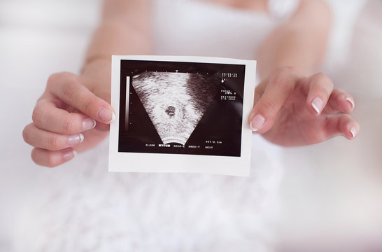 Pregnant women with the ultrasound picture