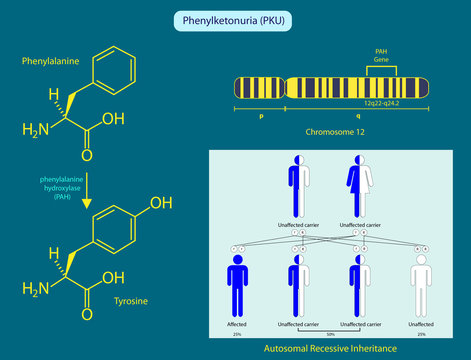 Phenylketonuria