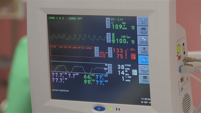 ECG monitor in the operational