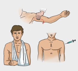 First aid for arterial bleeding hands.First aid.