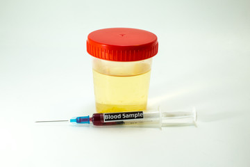 blood to be analyzed and a specimen of urine