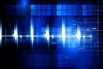 Electrocardiogram