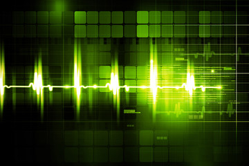 Electrocardiogram