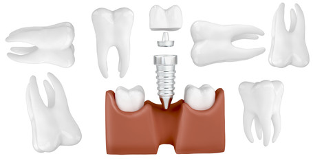 set design for dentists teeth on a white background