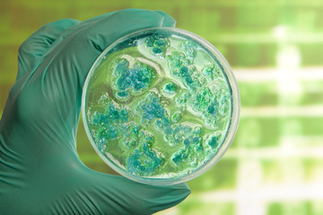 Petri dish with virus cells