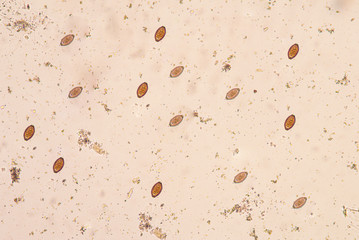 The human whipworm (Trichuris trichiura or Trichocephalus trichi