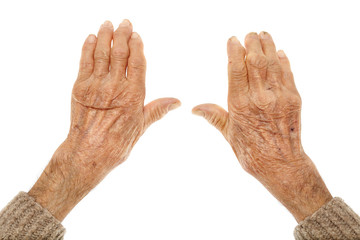 Old hands with artritis