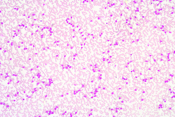 A blood smear is often used as a follow-up test to abnormal resu